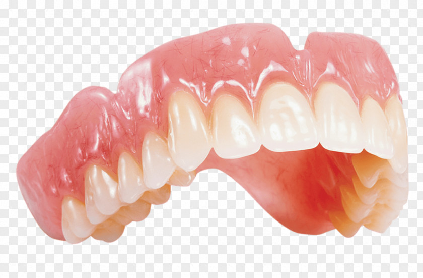 Chewing Gum Dentures Removable Partial Denture Dentistry Dental Laboratory Crown PNG