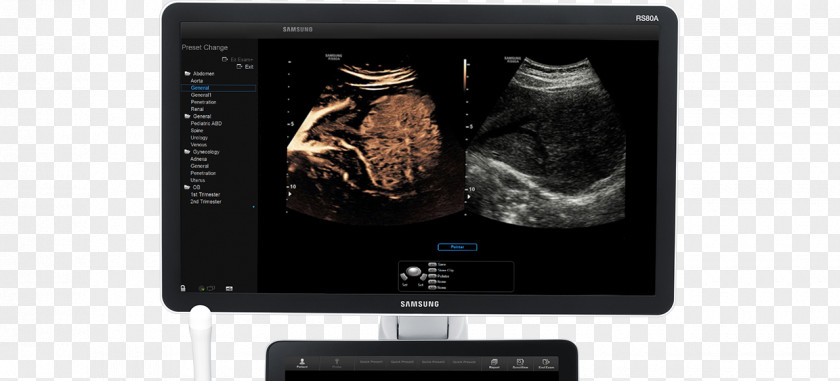 Hinh Bong Hoa Dao Contrast Agent Ultrasonography Ultrasound Radiography Medical Imaging PNG