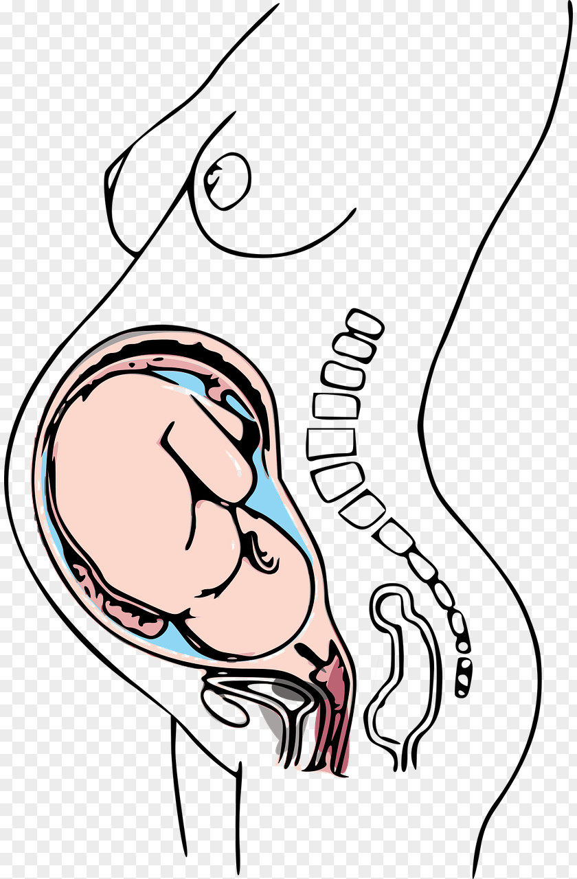 Pregnant Pregnancy Caesarean Section Prenatal Care Morning Sickness Woman PNG