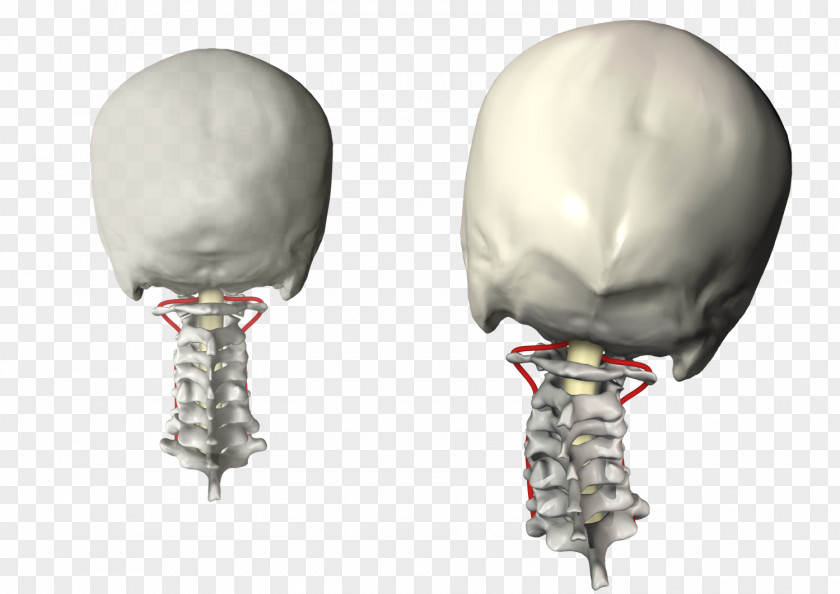 Vertebral Subluxation Column Cervical Vertebrae Chiropractic PNG