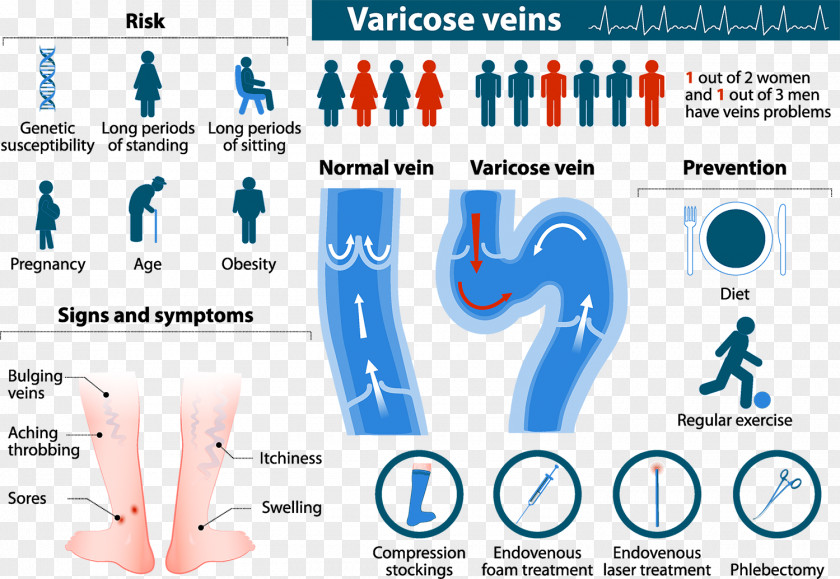 Varicose Veins Telangiectasia Risk Factor Therapy PNG