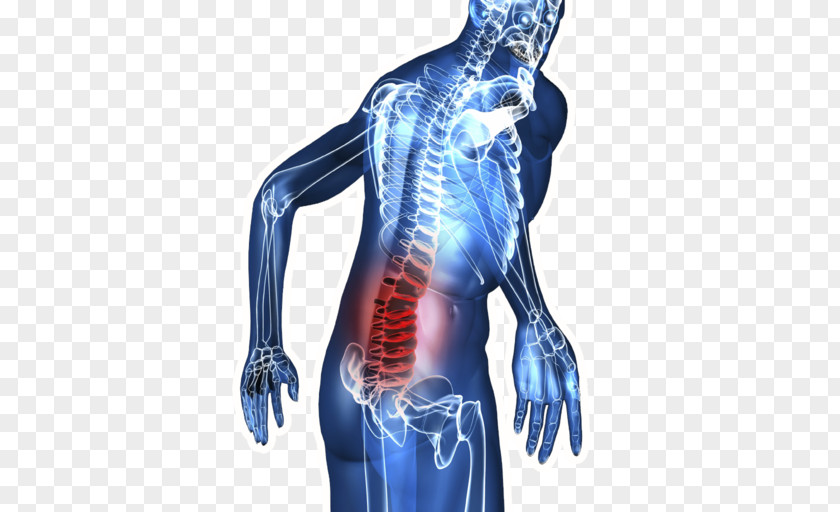 Back Pain Low Neck Injury Human PNG