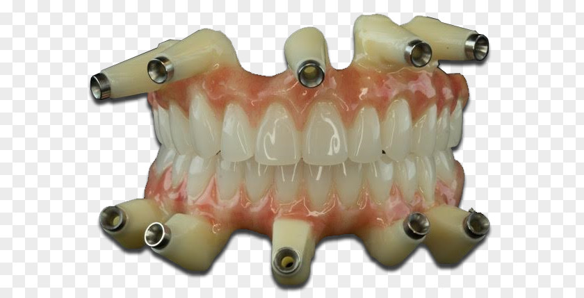 Dental Model Laboratory Dentures TC Lab Dentistry Jaw PNG