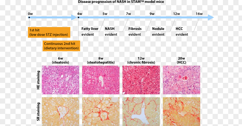 Pathology Lab Non-alcoholic Fatty Liver Disease Computer Mouse Model Degeneration PNG