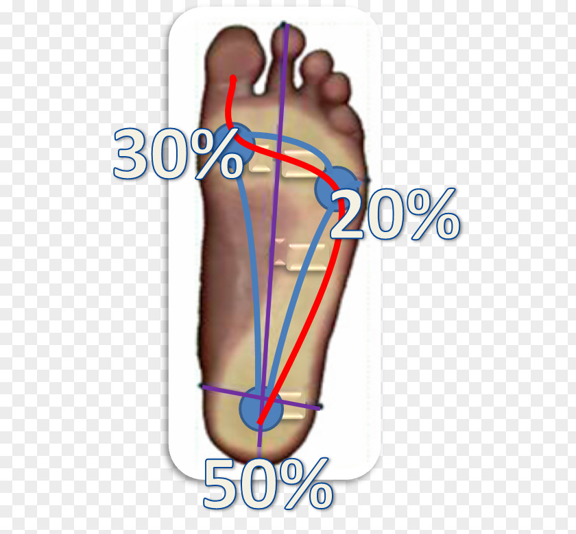 Esame Baropodometrico Thumb Foot Orthopaedics Metatarsal Bones PNG