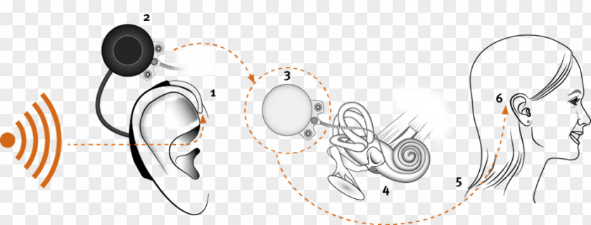 Ear Cochlear Implant Sound PNG