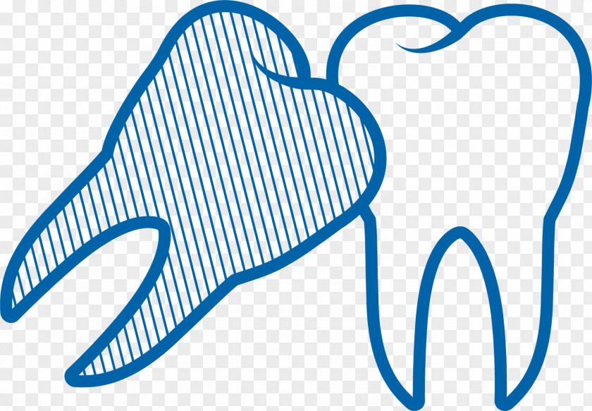 Tooth Surgery Arizona Dental Human Extraction Wisdom PNG
