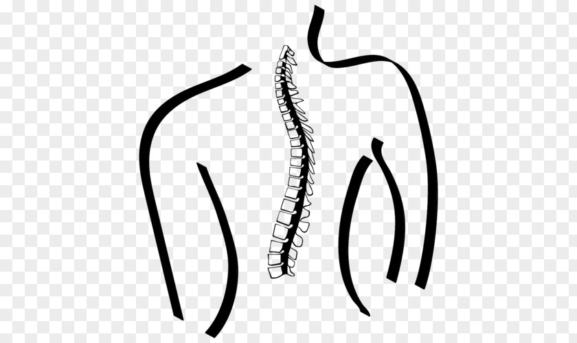 Back Pain Physical Therapy Thornleigh Performance Physiotherapy Chronic Clip Art PNG