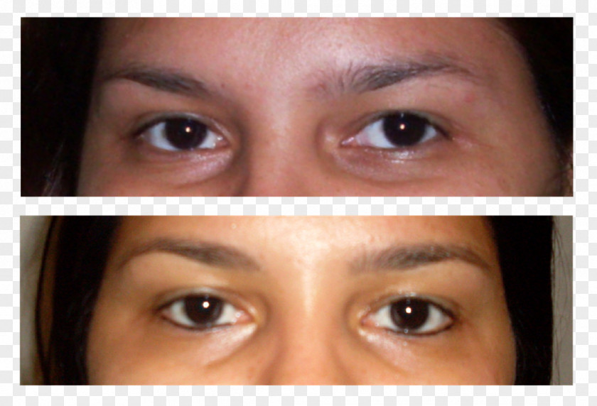 Nose Eyelash Extensions Eyebrow Cheek Chin Forehead PNG