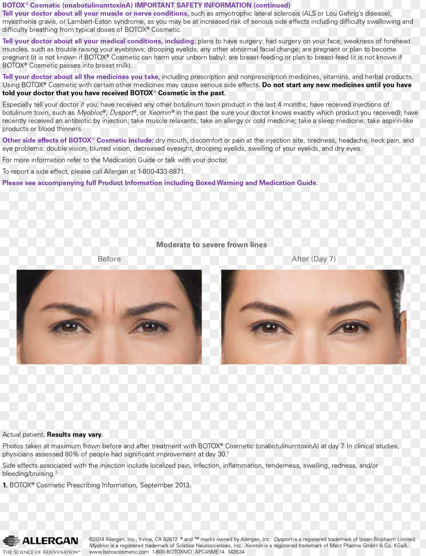 Aesthetics Botulinum Toxin Injection Wrinkle Surgery PNG