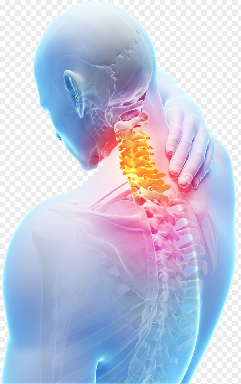 Painful Neck Pain Spinal Disc Herniation Cervical Vertebrae Vertebral Column Degenerative Disease PNG