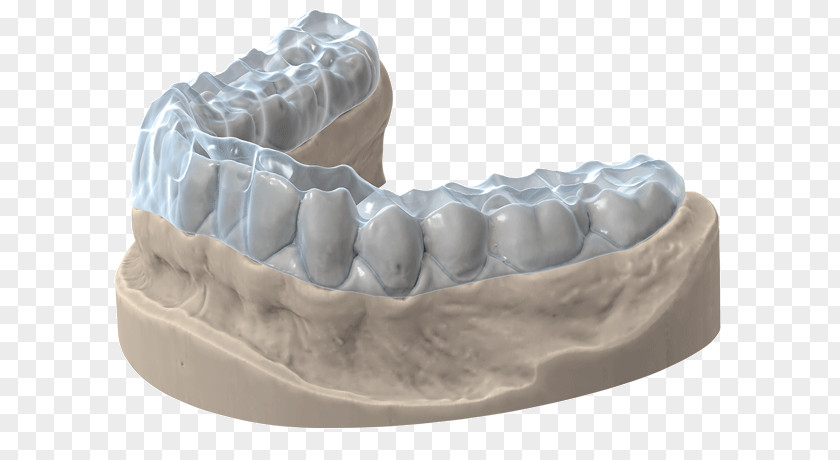 Occlusal Splint 3D Scanner Tooth Computer Software Image Printing PNG