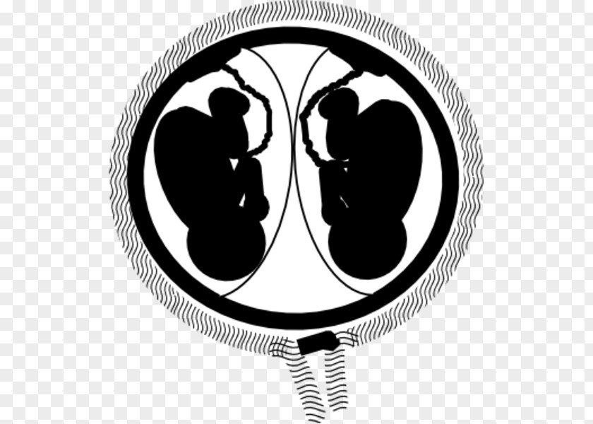 Twins Twin Pregnancy Fetus Uterus Clip Art PNG